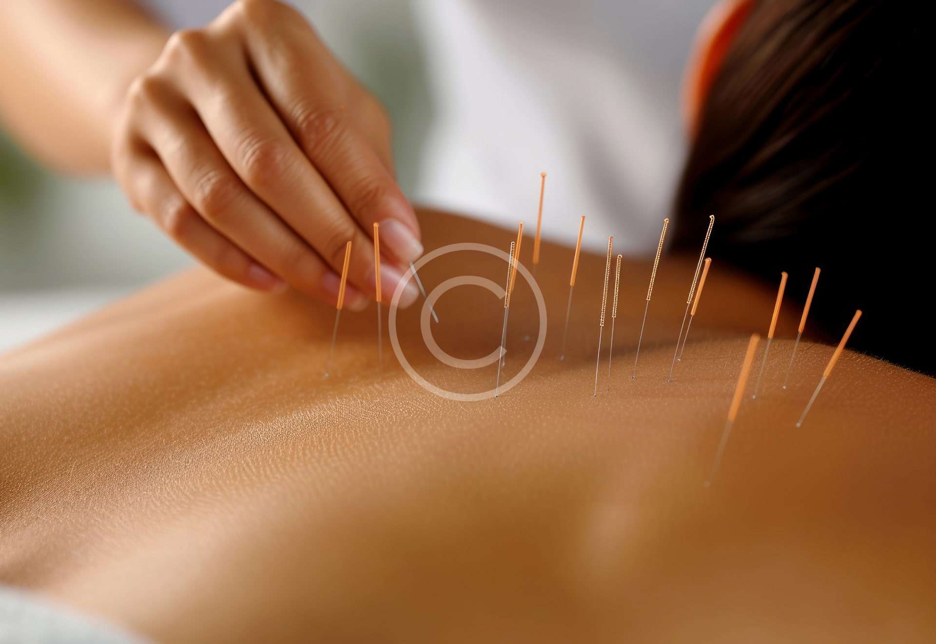 Acupuncture : soulager naturellement le stress, les douleurs et retrouver son équilibre